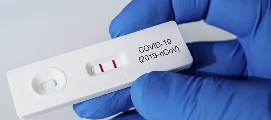 La venta diaria de autotest Covid pasó de 5.087 a casi 9.000 en menos de una semana
